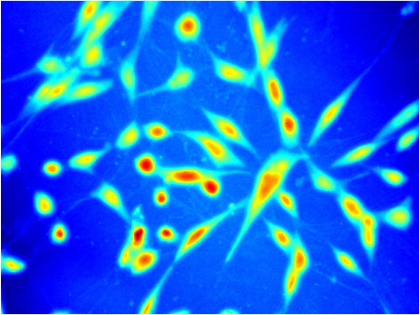 Projects – Quantitative Computational Imaging LAB